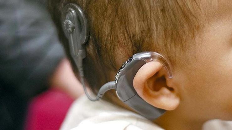 Cochlear Implant vs Hearing Aid – Understanding How They Are Different