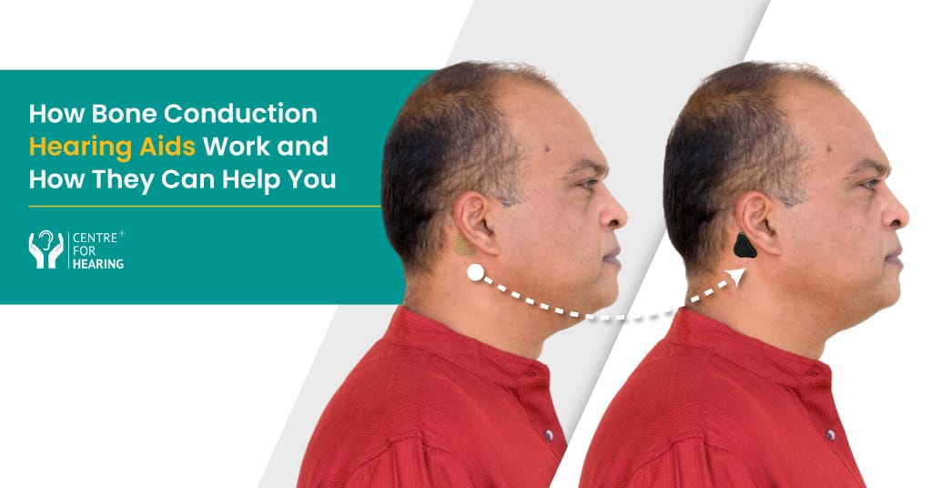 You’ll Never Believe How Bone Conduction Hearing Aids Work! (And How They Can Help You)
