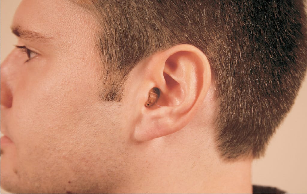Completely-in-Canal (CIC) on ear