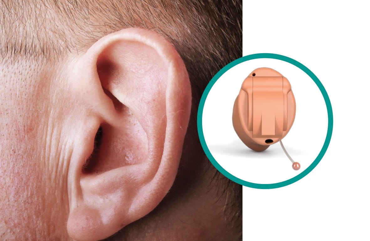 Invisible-in-Canal (IIC) Hearing Aids