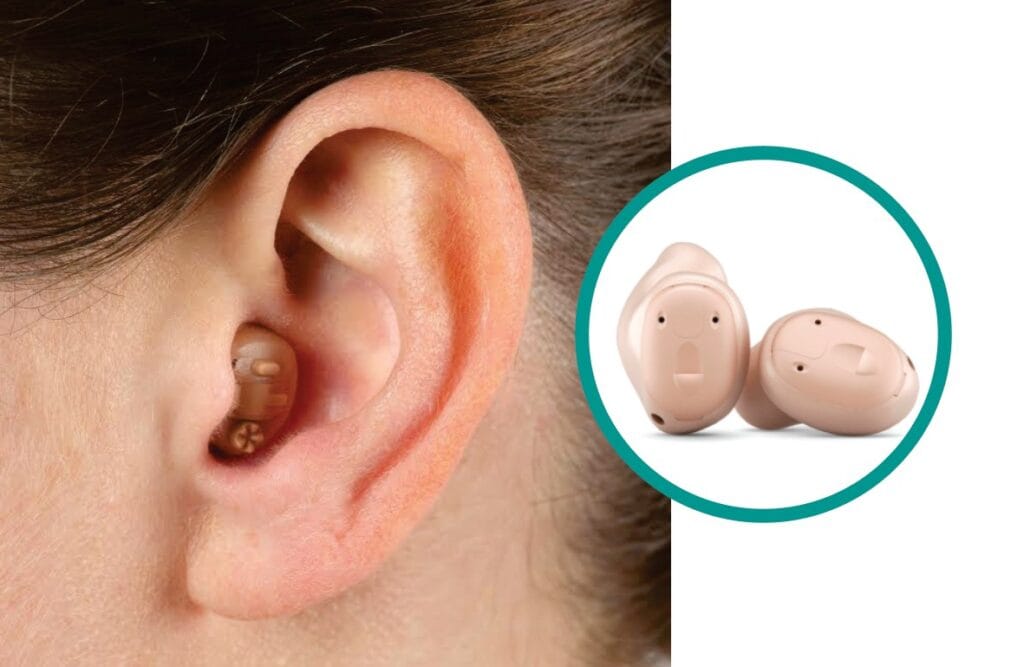 In-the-Canal (ITC) Hearing Aids